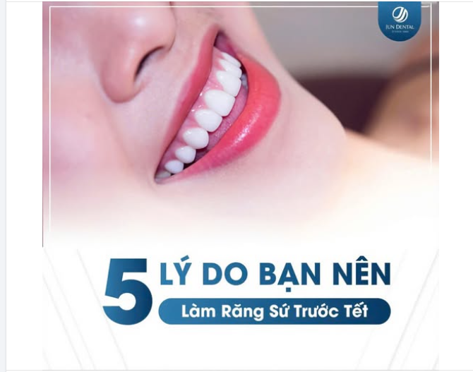 TẠI SAO NÊN LÀM RĂNG THẨM MỸ TRƯỚC TẾT ÍT NHẤT 1 THÁNG?