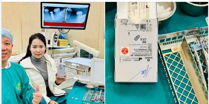 NHỔ RĂNG CẮM TRỤ IMPLANT TỨC THÌ – GIẢI PHÁP NHANH GỌN CHO KHÁCH HÀNG