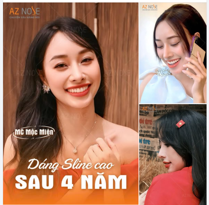 MC Mộc Miên tự tin toả sáng với dáng mũi Sline cao sau 4 năm