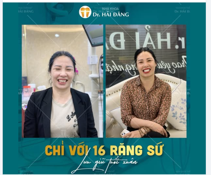 CHỈ VỚI 16 RĂNG SỨ – NỤ CƯỜI NHƯ TRẺ LẠI VÀI TUỔI