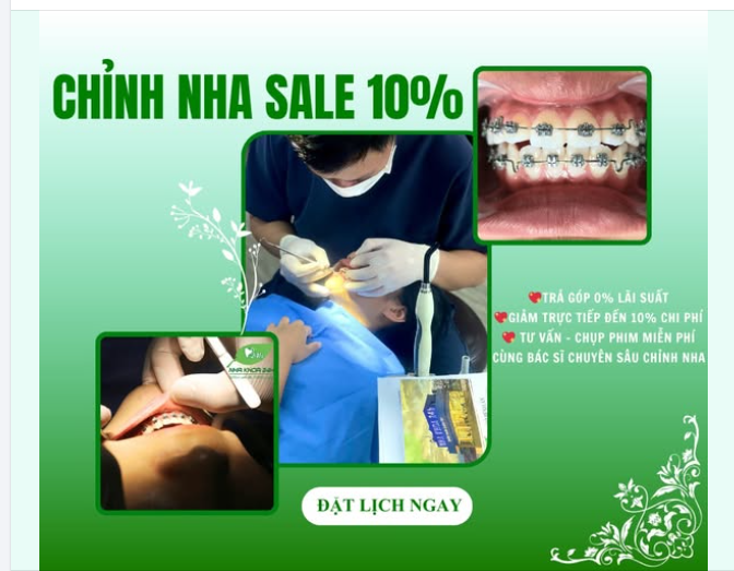 CHỈNH NHA GIẢM NGAY 10% – CƠ HỘI ĐẸP NỤ CƯỜI TRƯỚC TẾT
