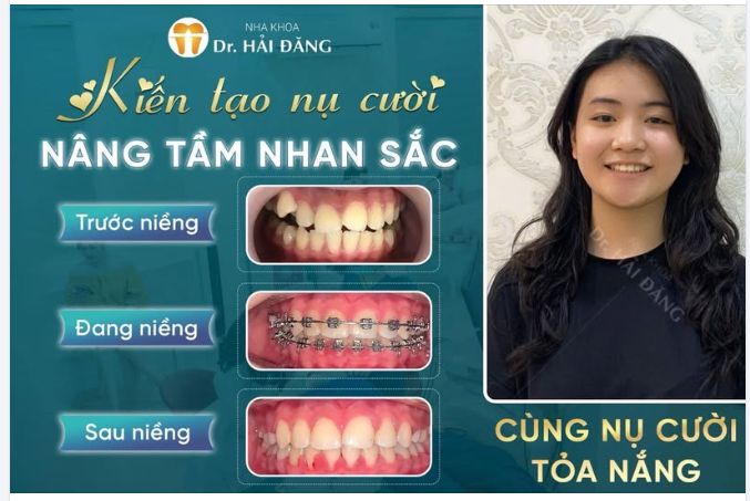 KIẾN TẠO NỤ CƯỜI – NÂNG TẦM NHAN SẮC