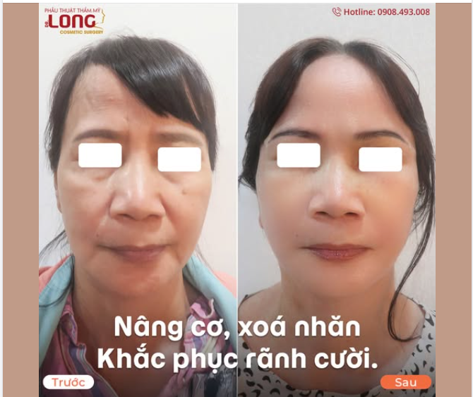 BÁC SĨ LONG “LÀM QUÁ…”  Khách chia sẻ: "Bác làm xong thấy làm quá….đẹp"