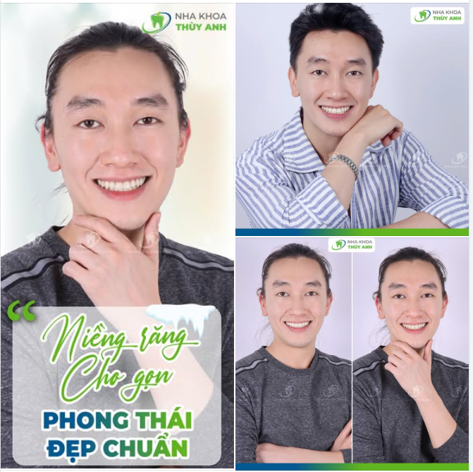 CHỈ CẦN NỤ CƯỜI ĐẸP, GIAO DIỆN NÀO CŨNG THU HÚT