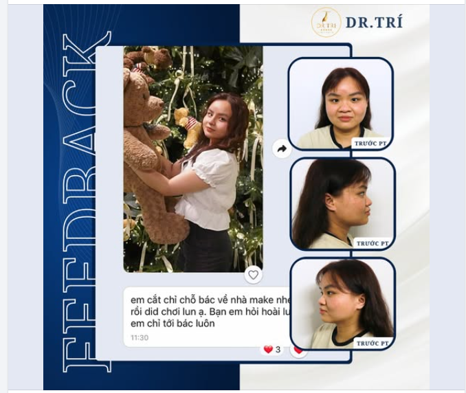 FEEDBACK SAU PHẪU THUẬT: ĐẸP TỰ NHIÊN ĐẾN MỨC "AI CŨNG HỎI HOÀI"!