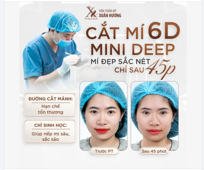 45 PHÚT THAY ĐỔI ĐÔI MẮT, CẢI THIỆN KHUYẾT ĐIỂM TRÊN KHUÔN MẶT