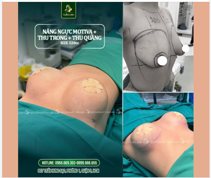 KHOẢNG KHẮC THAY ĐỔI CẢ VÓC DÁNG