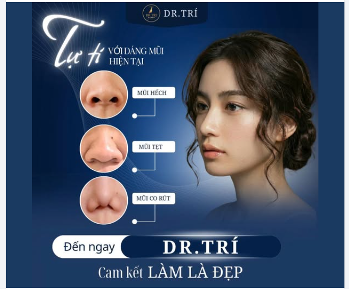 MŨI HẾCH, TẸT, CO RÚT? NÂNG MŨI TẠI DR.TRÍ - LÀM LÀ ĐẸP!