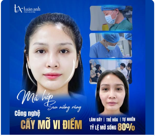 SAU NIỀNG RĂNG MÁ HÓP, THÁI DƯƠNG LÕM: Làm sao để khắc phục?