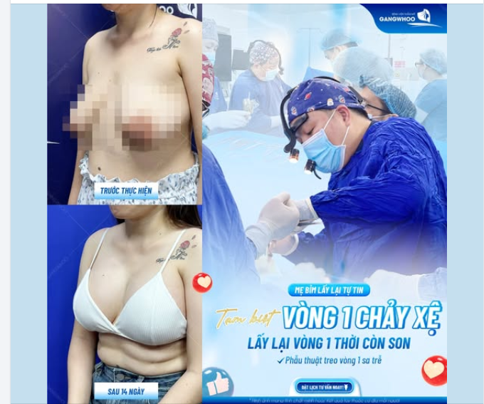 MẸ BỈM LẤY LẠI TỰ TIN - TẠM BIỆT VÒNG 1 CHẢY XỆ, LẤY LẠI VÒNG 1 THỜI CÒN SON