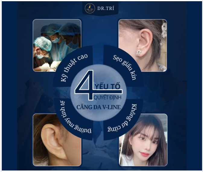 CĂNG DA V-LINE: NẮM GIỮ 4 YẾU TỐ VÀNG – TRẺ HÓA TUYỆT ĐỐI!