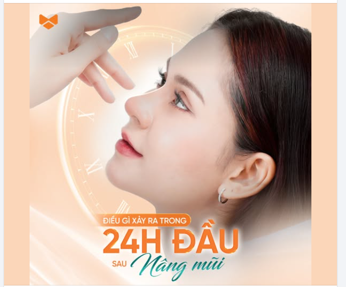 24 GIỜ ĐẦU SAU NÂNG MŨI – KHI CƠ THỂ ĐANG “LÀM QUEN” VỚI DÁNG MỚI