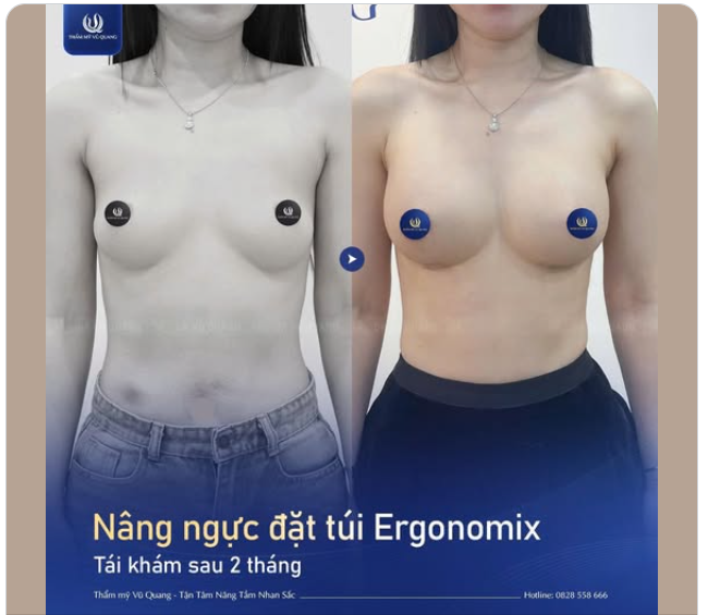 Một sự thay đổi ngoạn mục chỉ sau 2 tháng "trùng tu" của mẹ 2 con!