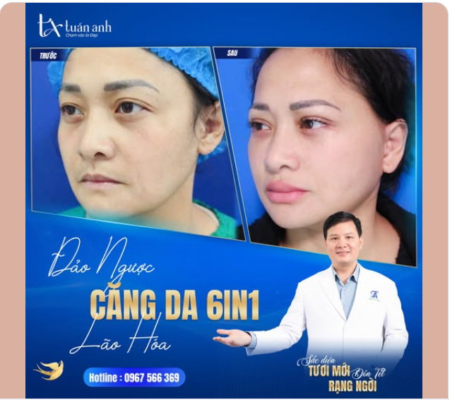 ĐẢO NGƯỢC LÃO HÓA – TỰ TIN KHOE SẮC DIỆN MỚI