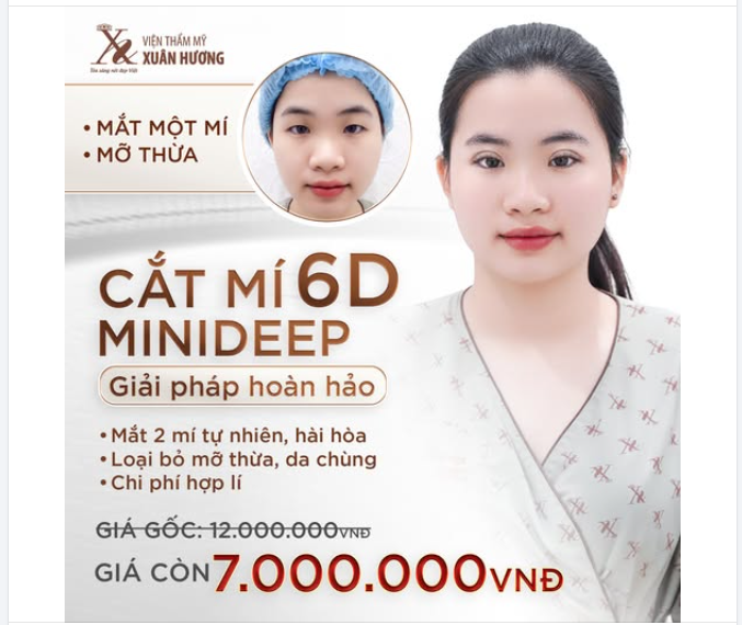 SALE SIÊU SỐC CẮT MÍ MINIDEEP 6D CHỈ CÒN 7 TRIỆU ĐỒNG