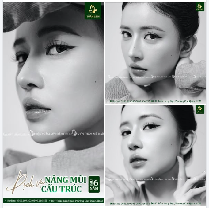 Định luật nào cấm người đẹp nâng mũi để đẹp hơn?