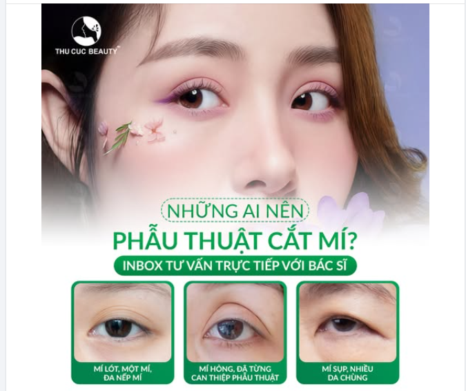 NHỮNG AI NÊN PHẪU THUẬT CẮT MÍ?