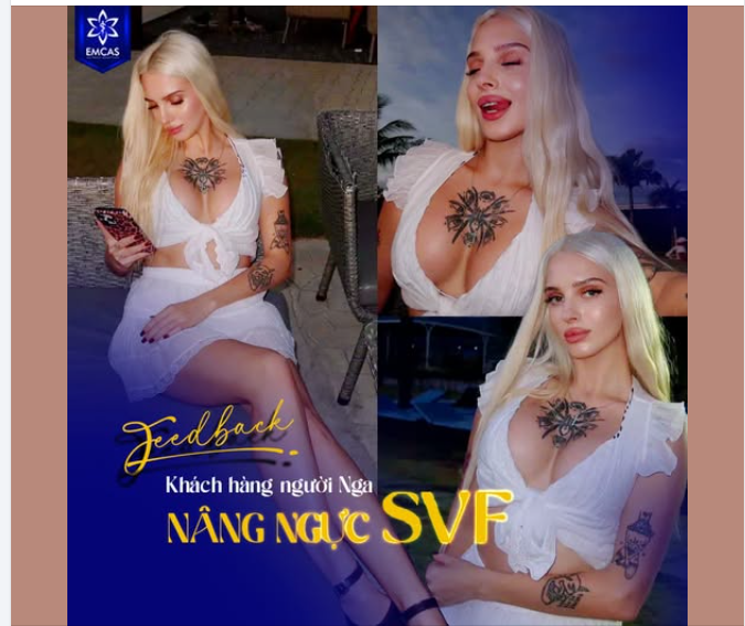 FEEDBACK KHÁCH HÀNG NGƯỜI NGA NÂNG NGỰC SVF TẠI EMCAS