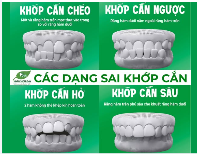 CÁC DẠNG SAI KHỚP CẮN BA MẸ KHÔNG THỂ BỎ QUA