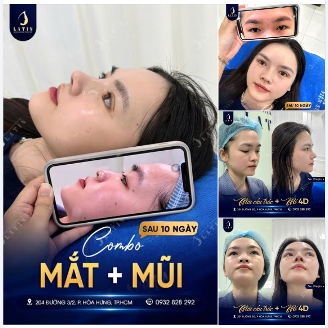 COMBO MẮT – MŨI SAU 10 NGÀY: NHAN SẮC “LÊN HƯƠNG” KHÔNG CẦN MAKEUP