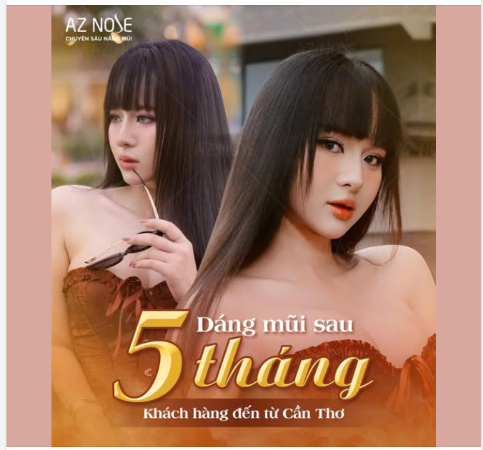 GenZ Cần Thơ cực "slay" với dáng mũi Sline cao sau 5 tháng