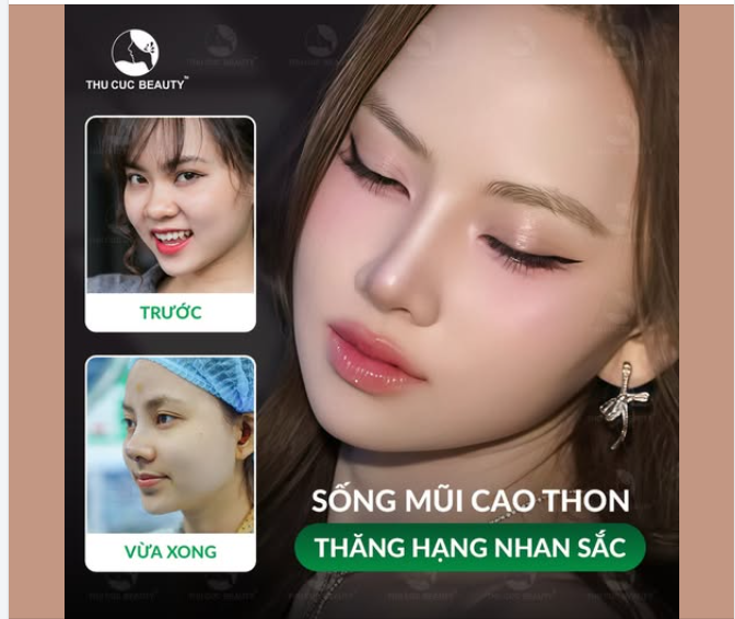 Ngô Lan Hương đã thăng hạng nhan sắc thế nào sau nâng mũi?