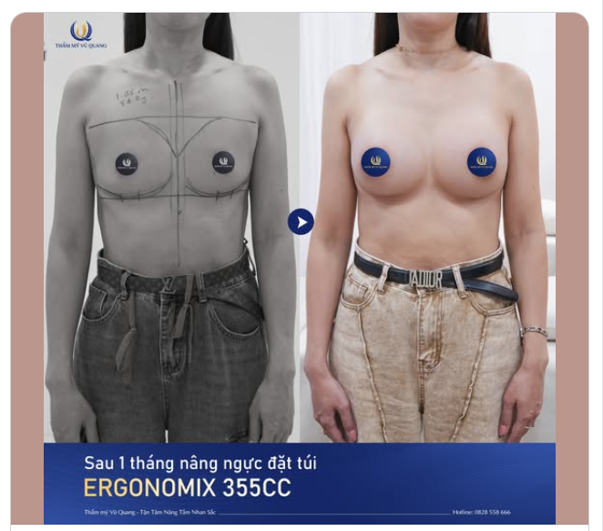 Sự thay đổi ngoạn mục của mẹ 2 con!