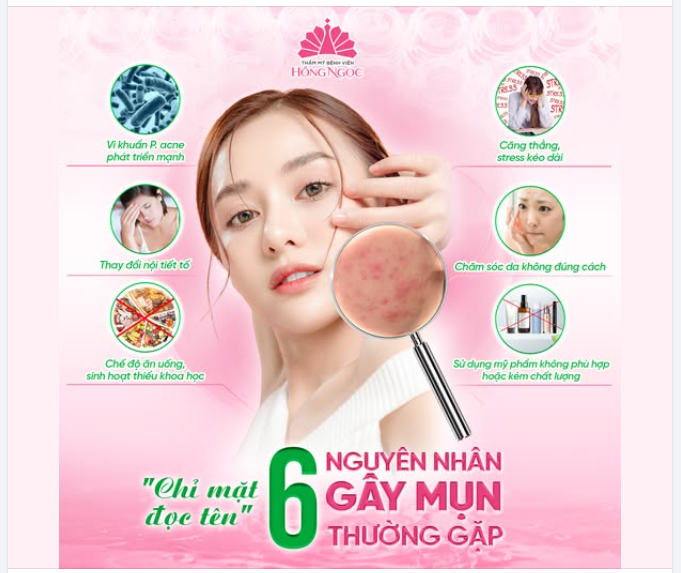 "CHỈ MẶT ĐỌC TÊN" 6 NGUYÊN NHÂN CHÍNH GÂY RA MỤN