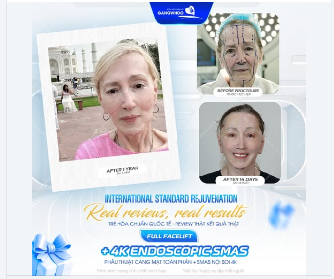 Đột phá công nghệ trẻ hóa - Tái tạo thanh xuân chỉ sau 1 lần thực hiện: