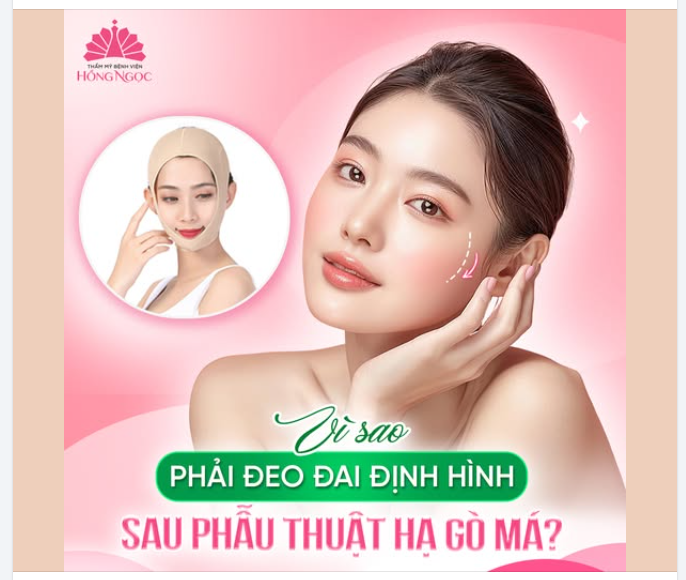 VÌ SAO PHẢI ĐEO ĐAI ĐỊNH HÌNH MẶT SAU KHI HẠ GÒ MÁ?