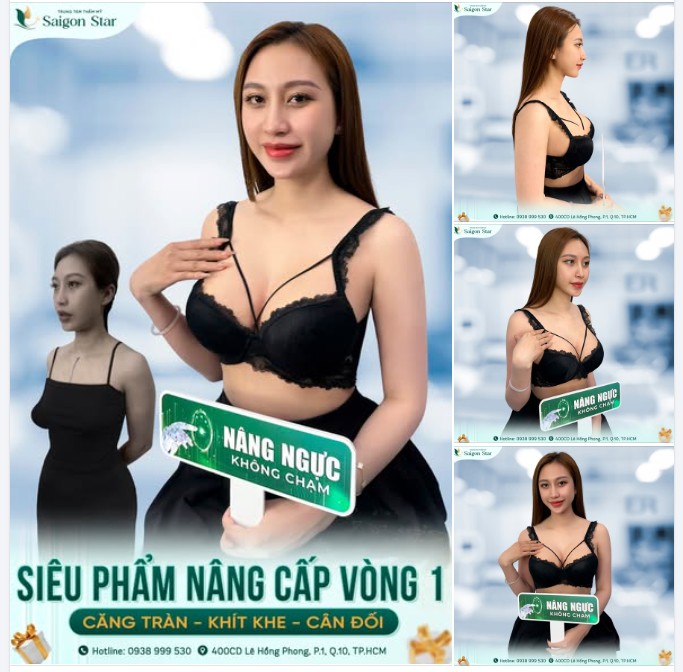 SIÊU PHẨM NÂNG CẤP VÒNG 1 TẠI SAIGON STAR – MỀM MẠI, CHUẨN FORM SAU 10 NGÀY