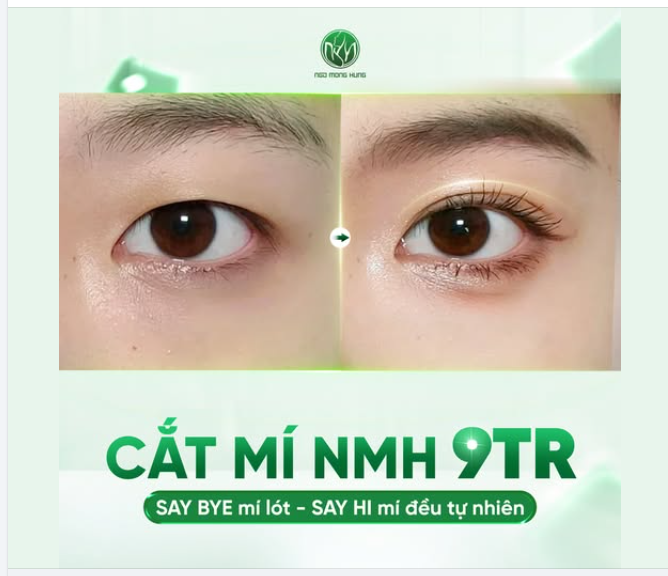 Say bye mí lót - Say hi mí đều tự nhiên