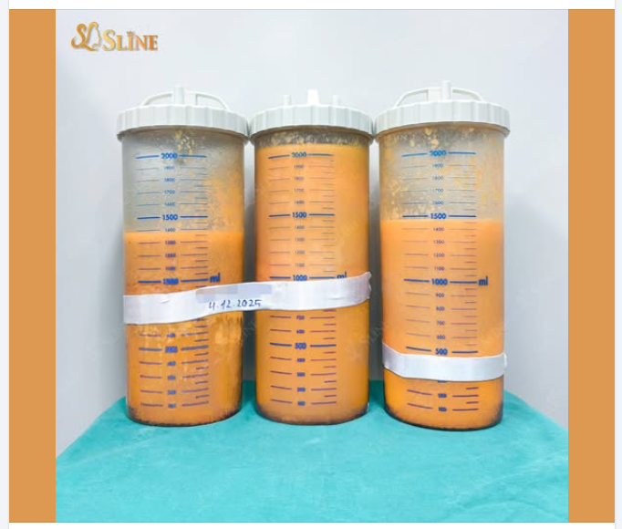 ĐỐ VUI CÓ THƯỞNG!  3 bình mỡ – gần 6 LÍT trong hình…