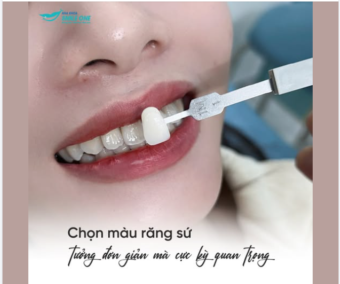 Việc lựa chọn màu răng sứ trước khi tiến hành phục hình được coi là bước quan trọng, quyết định kết quả cuối cùng của hàm răng. Tại sao lại như vậy?