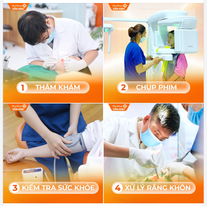 NHỔ RĂNG KHÔN SAI CÁCH VÀ NHỮNG BIẾN CHỨNG SAU ĐÓ