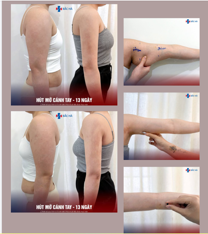 ĐANG PHÂN VÂN THÌ ĐỪNG VỘI LƯỚT QUA.