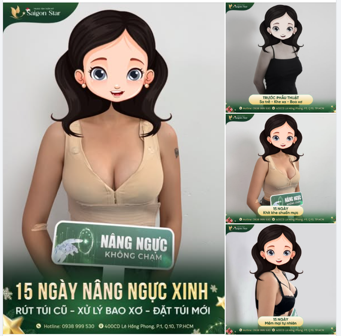 THÀNH CÔNG SỬA LẠI VÒNG 1 - CĂNG TRÒN QUYẾN RŨ