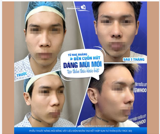 Bạn có từng nghĩ chỉ một đường nét thay đổi có thể tạo nên sự khác biệt đến khó tin?