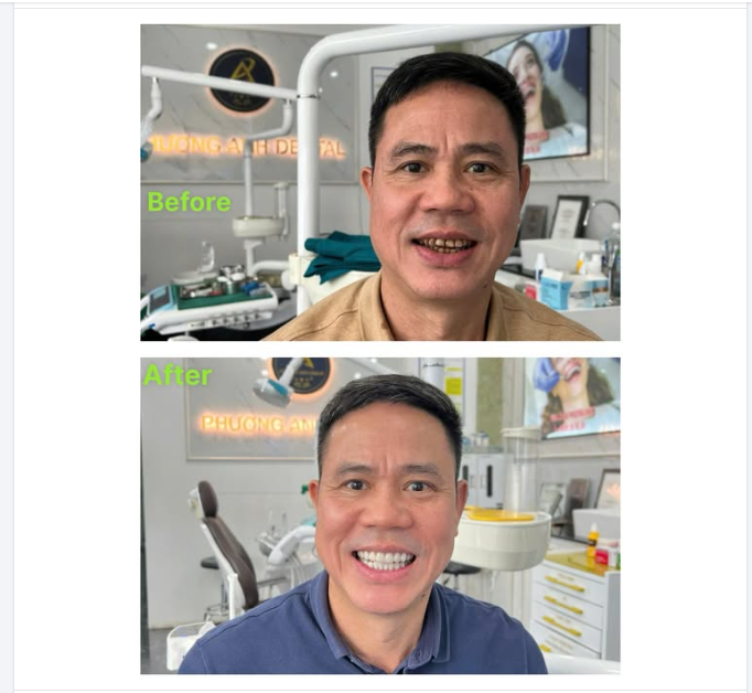 Một hàm răng đẹp không chỉ giúp tự tin hơn, mà còn mở ra nhiều cơ hội hơn trong cuộc sống.