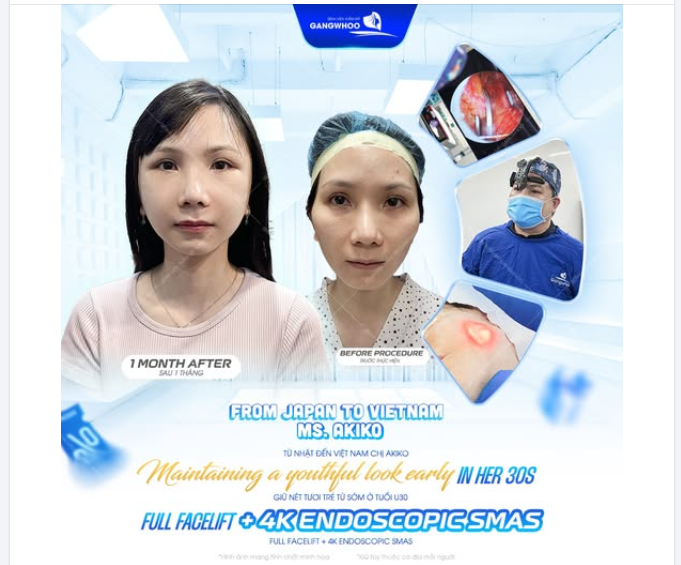 ​​​​​​​Ở tuổi ngoài 30, khi những dấu hiệu đầu tiên của lão hóa bắt đầu xuất hiện.