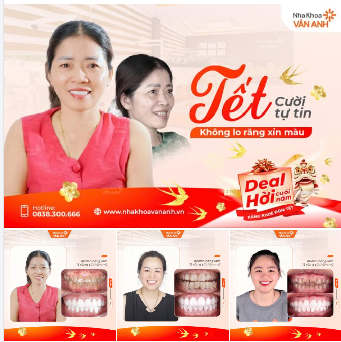 TẠM BIỆT RĂNG Ố VÀNG – CƯỜI ĐÓN LỘC XUÂN SANG
