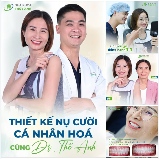 DÁNG RĂNG OVAL - TÔN TẠO VẺ ĐẸP TỰ NHIÊN, TINH TẾ
