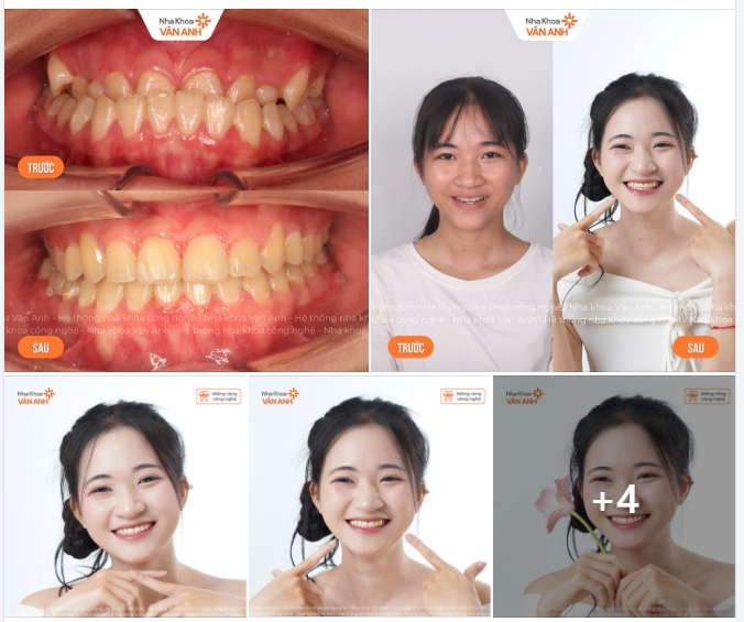 Lưu giữ hành trình rực rỡ - Mỗi nụ cười đều xứng đáng được lưu giữ