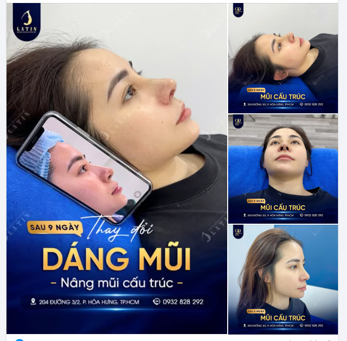 THAY ĐỔI DIỆN MẠO MỚI CHỈ SAU 9 NGÀY TẠI LATIN
