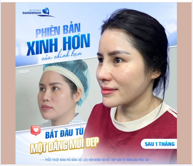 TRỞ THÀNH PHIÊN BẢN HOÀN HẢO HƠN CỦA BẢN THÂN