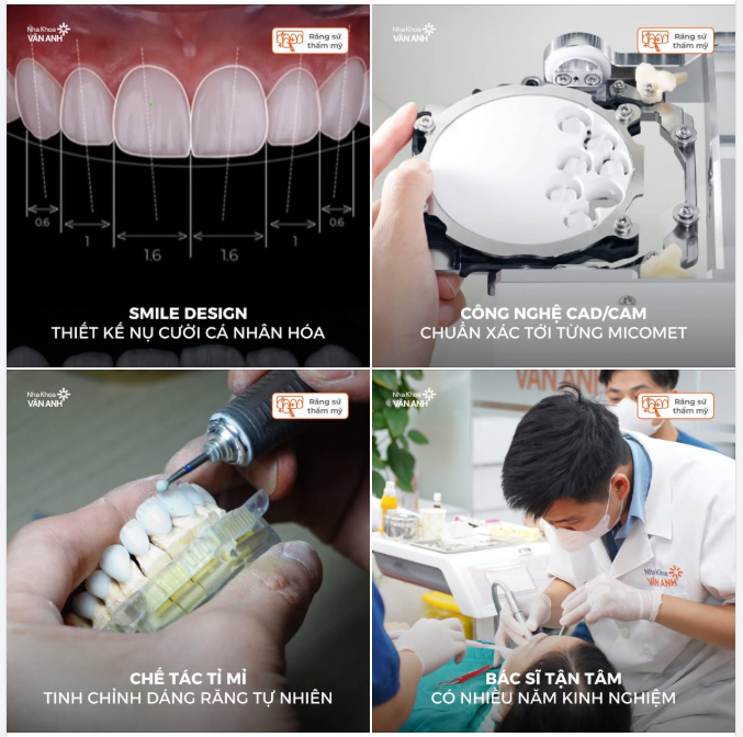 BÍ MẬT ĐẰNG SAU NHỮNG CHIẾC RĂNG SỨ HOÀN HẢO