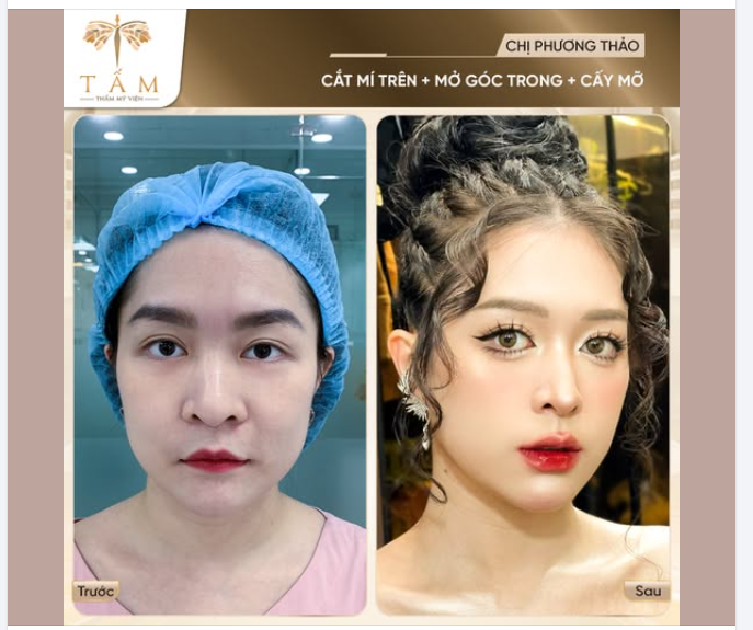 Cảm ơn chị đã tin chọn và gửi feedback cho Tấm