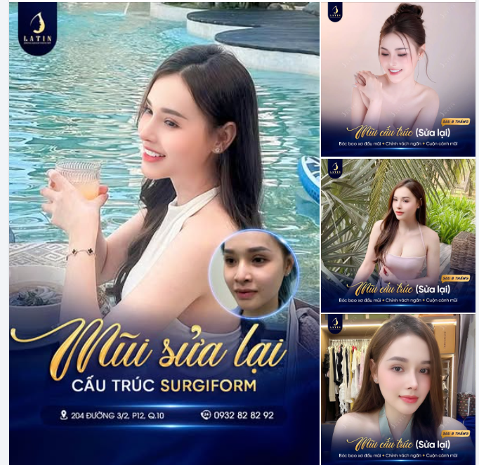 SAU 8 THÁNG NÂNG MŨI TÁI CẤU TRÚC: TẠM BIỆT MŨI LỖI - CHÀO ĐÓN NHAN SẮC MỚI