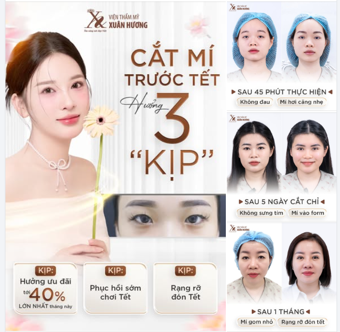 KỊP KHÔNG EM? – DẠ KỊP! KỊP CẮT MÍ ĐỂ ĐÓN TẾT TẠI VTM XUÂN HƯƠNG