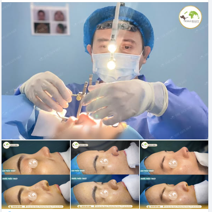 Không phải dáng mũi nào cũng chỉ cần đặt sóng là đủ.